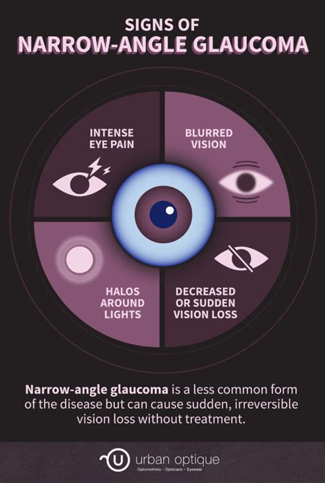 What Is Narrow Angle Glaucoma Urban Optique