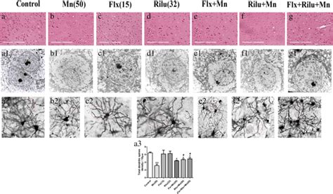 Light Microphotographs Showing Histomorphological Changes In Striatum