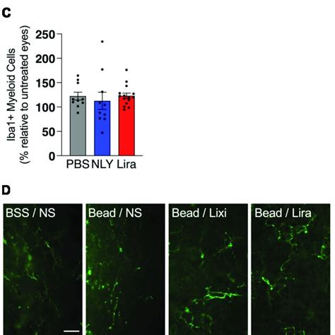 GLP 1R Agonists Do Not Affect The Number Of Iba1 Cells In The Retina