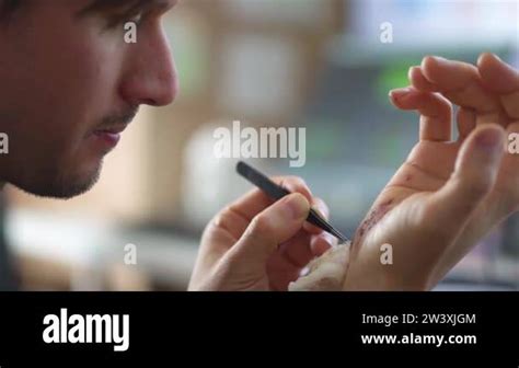 Man Cleaning A Bleeding Wound Under The Skin After The Accident