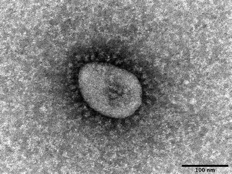 コロナ禍、新年早々第6波の様相 オミクロン株、新規感染者の約半数に Science Portal 科学技術の最新情報サイト「サイエンス