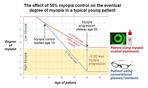 Bay Eye Care Myopia Control Slowing Short Sightedness