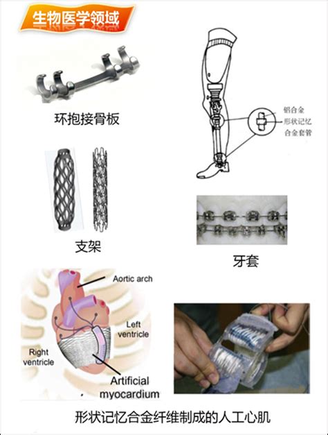 形状记忆合金，超级神奇的功能材料！