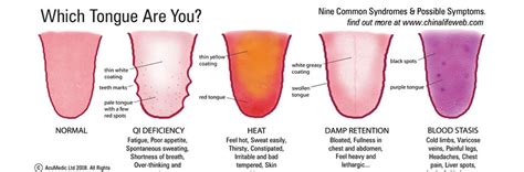 Tongue Diagnosis