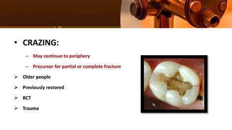 Principles For Restoration Of Badly Broken Teeth Ppt