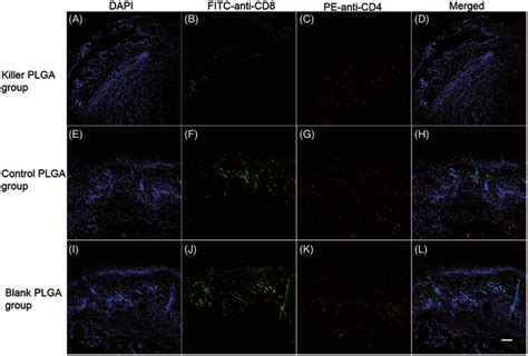 Immunofluorescence Localization Of CD4 And CD8 T Cells Infiltrating