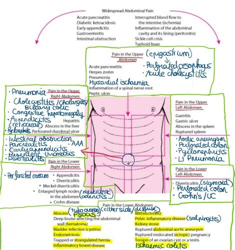 Acute Abdomen Flashcards Quizlet