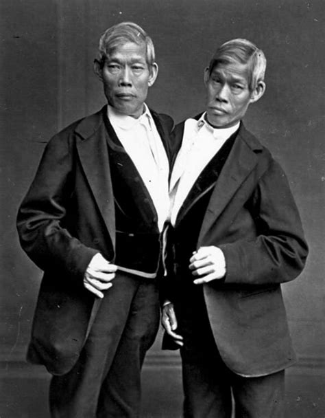 183 best Siamese Twins images on Pholder | Mildlyinteresting ...