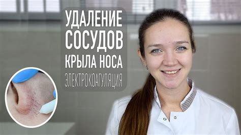 Удаление сосудистой сетки на лице | косметология Самара | Attributes