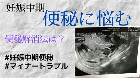 【妊娠中期】便秘に悩む妊婦🤰解消法はまさかのあのスーパーフード！ 便秘マイナートラブル妊娠中期妊婦 Youtube