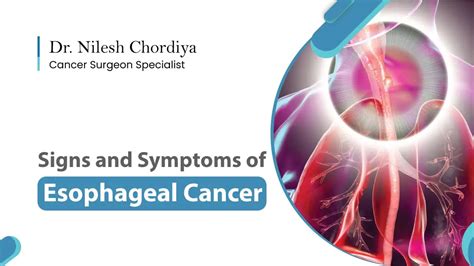 Esophageal Cancer: Symptoms, Risk Factors, and Early Detection