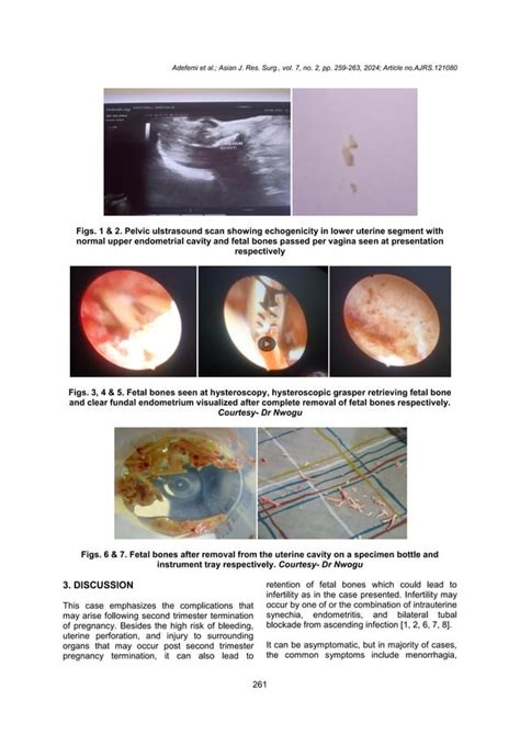 Real Time Ultrasound Guided Safe Insertion Of Veress Needle For