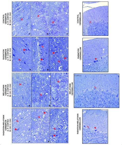 Neurons (∆), Purkinje neurons (>>) and dark neurons ( ) structures were ...