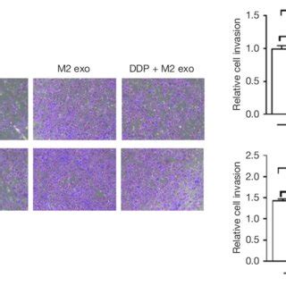 CD163 TAMs Exosomes Can Promote The Adhesion And Migration Of EOC