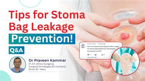 How To Prevent Stoma Bag Leakage Tips For Colorectal Cancer Patients