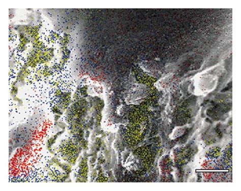 A Von Kossa Staining And Counterstaining With Methylene Blue Most