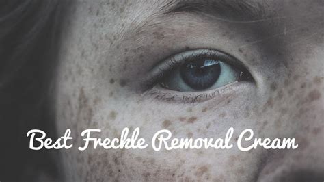 The Best Freckle Removal Cream [Reviews And Buying Guide] In 2024