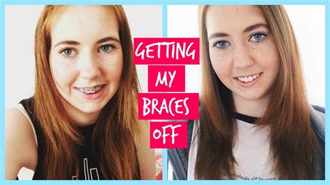 Vlog Of Getting My Braces Off After Years Youtube