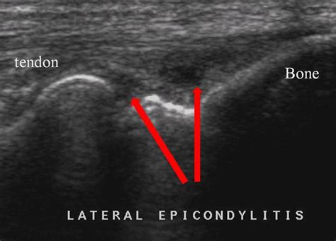 MSK Ultrasound Dr Iain Duncan