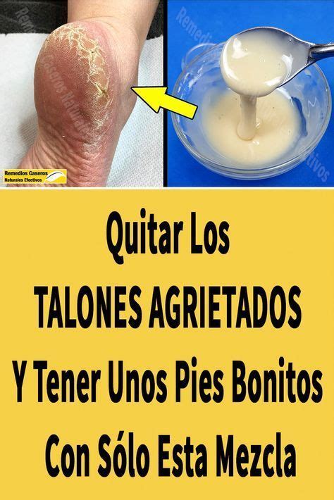 Quitar Los TALONES AGRIETADOS Y Tener Unos Pies Bonitos Con Sólo Esta