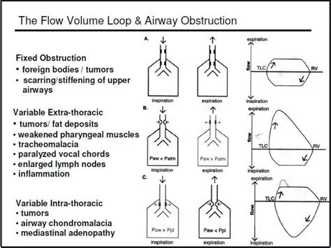 Pulmonary Flow Volume Loops Dr Padmesh Ppt