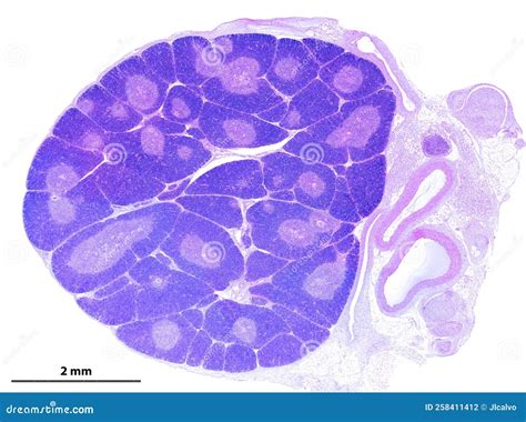 Thymus Histology Labeled Trabeculae