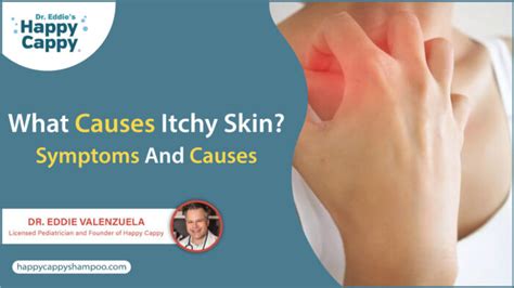 What Causes Itchy Skin Symptoms And Causes Dr Eddies Happy Cappy