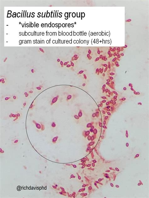 Bacillus Megaterium Spore Stain