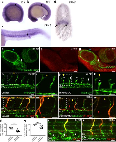 Tmem Knockdown Inhibits Angiogenesis And Localises To The Er In Ecs