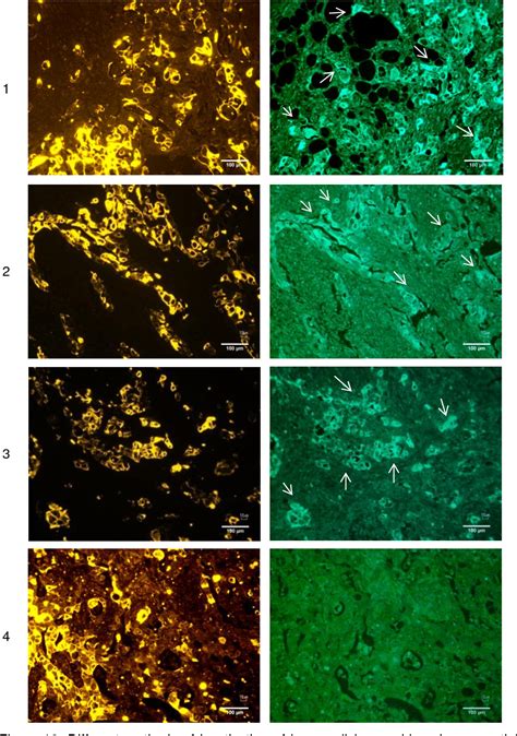 Figure 1 From Optimization Of Immunofluorescence Protocols For