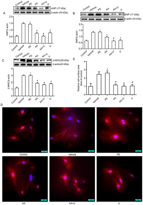 AA And U0126 Alleviates PE Induced Cardiomyocyte Hypertrophy A C