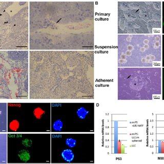 Characterization Of Tumor Derived From Spheroid Cells A Histology Of