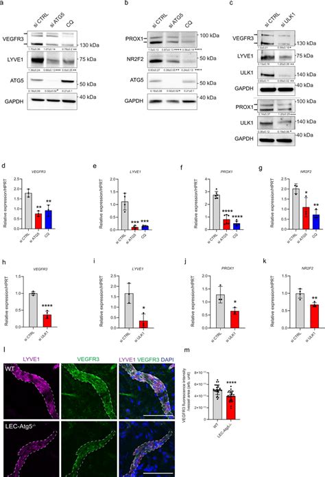 Autophagy Deficiency Impairs Expression Of Lymphatic Markers A B