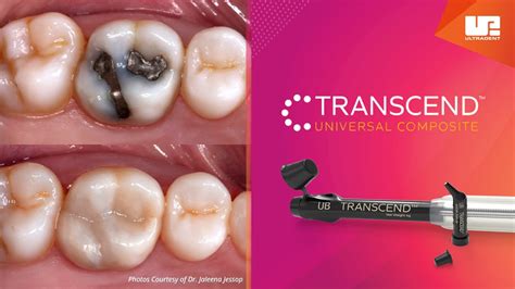 Transcend Universal Composite Youtube