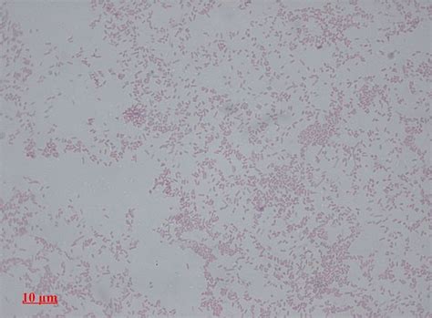 Proteus Mirabilis Antibiotic Susceptibility