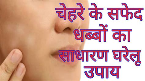 फस क दग धबब कस दर कर Face Ke Daag Kaise Hataye Chehre ke