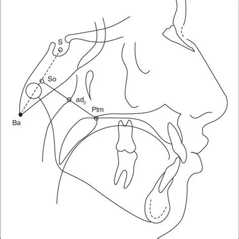 Cephalometric Tracing With The Ba Ptm S So And Ad 2 Reference Points Download Scientific