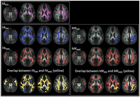 Neuroimage Mk Curve Medsci Cn