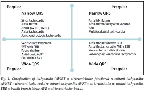 Oceania Indomitable Another Ventricular Tachycardia Classification