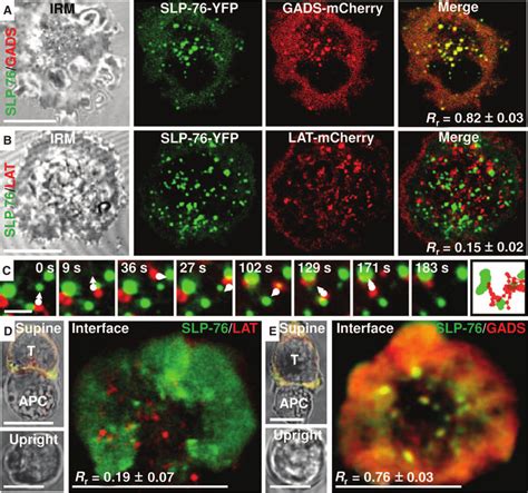 Heterogeneity In T Cell Protein Clusters A To C Images Show The