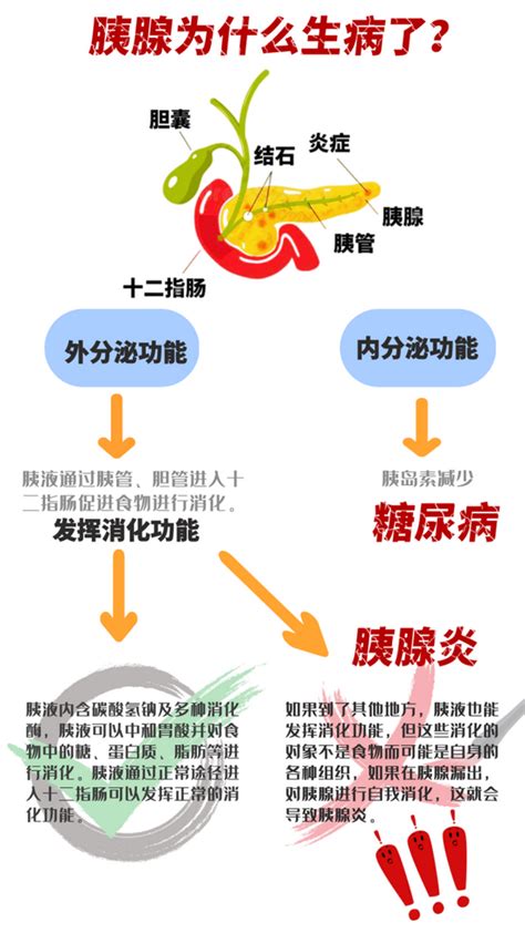 健康科普丨27岁网红博主去世 急性胰腺炎为何如此厉害 媒体摘编 山东大学齐鲁医院德州医院