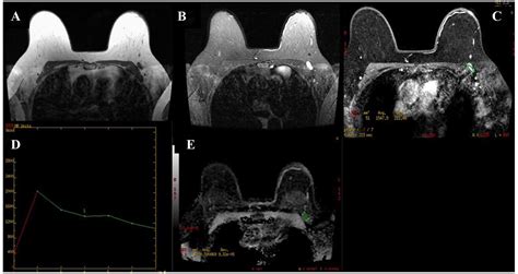 Role Of Short Term Follow Up Magnetic Resonance Imaging In The