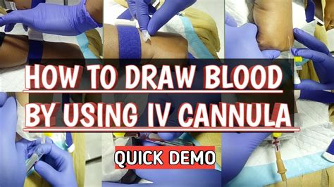 How To Draw Blood By Using IV Cannula Before Start Of IV Fluid Quick