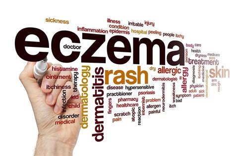 Can Stress Cause Eczema? - Healthier Steps