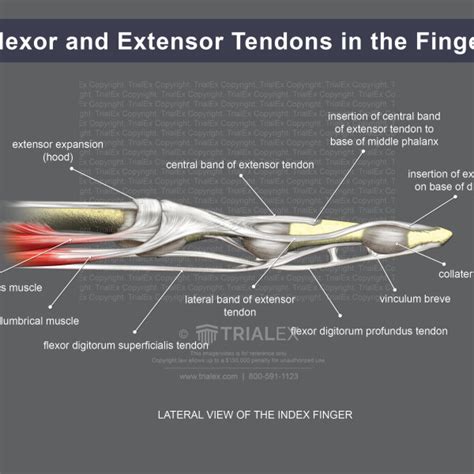 Medical Legal Exhibits Legal Animations Trial Graphics Tria