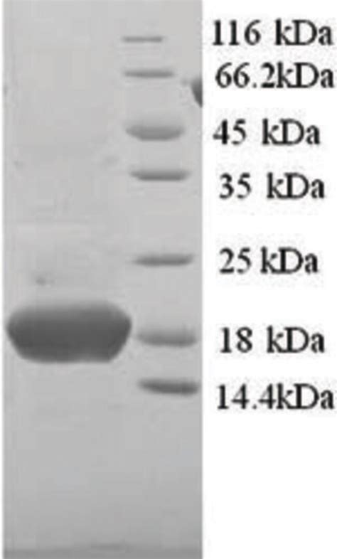 Enquirebio Recombinant Human Phpt Php Protein G Fisher