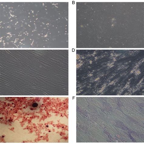 Morphology Of Aml Mscs A Aml Mscs Cultured After 7 10 Days B Download Scientific Diagram