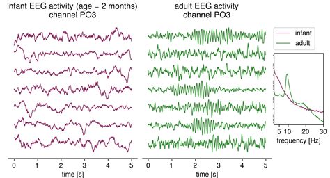 Longitudinal Changes In Aperiodic And Periodic Activity In