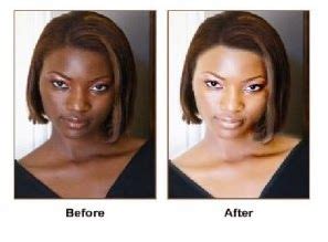 Skin Bleaching Cream Before And After Pictures - PictureMeta