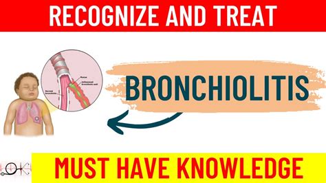 What Is Bronchiolitis Rsv All You Need To Know Causes Symptoms